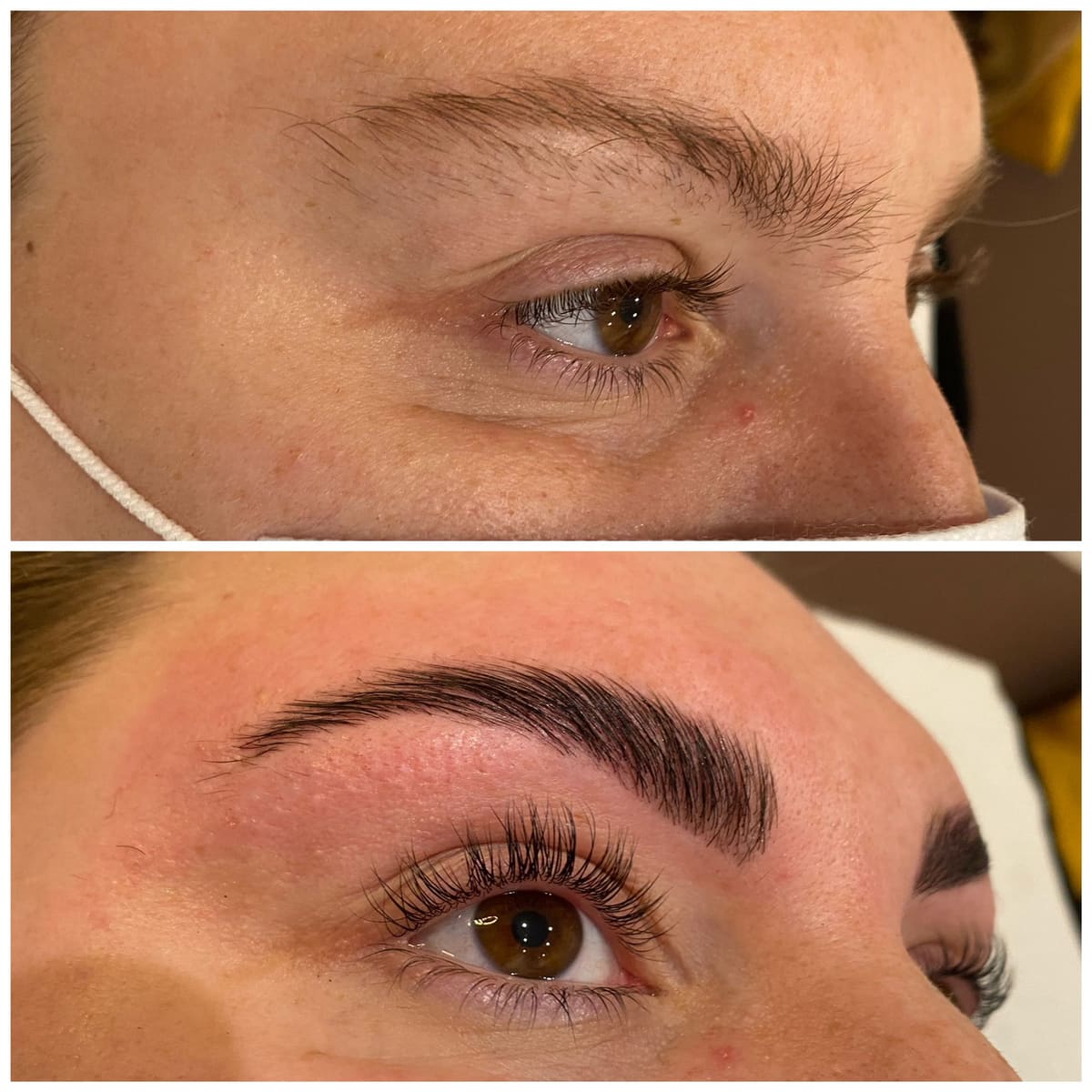 Voor/na van een browlift: geherstructureerde en mooi in model gebrachte wenkbrauwen